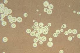 cryptococcus neoformans